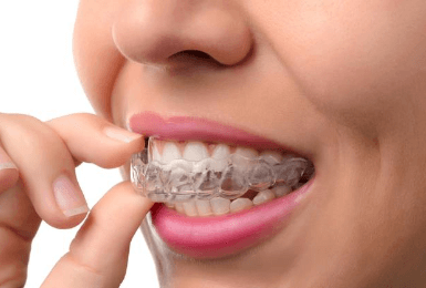 invisalign