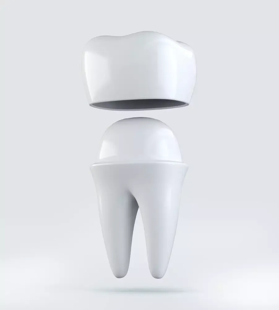  Dental Crowns 